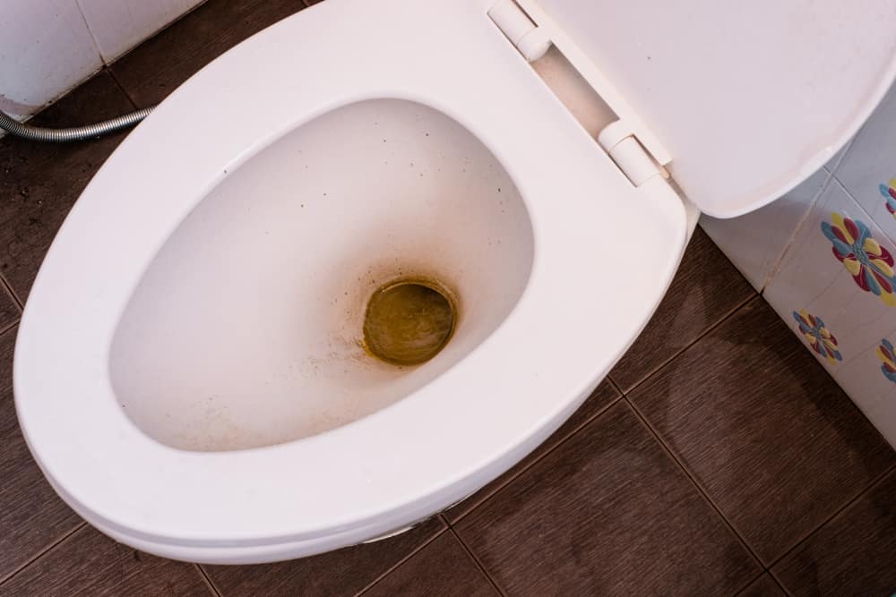 How To Clean Poop Stains From Toilet Bowl