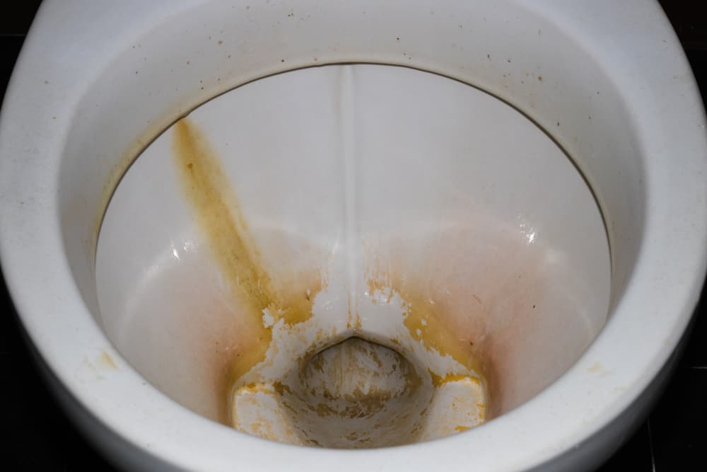 How do you get old poop stains out of a toilet?