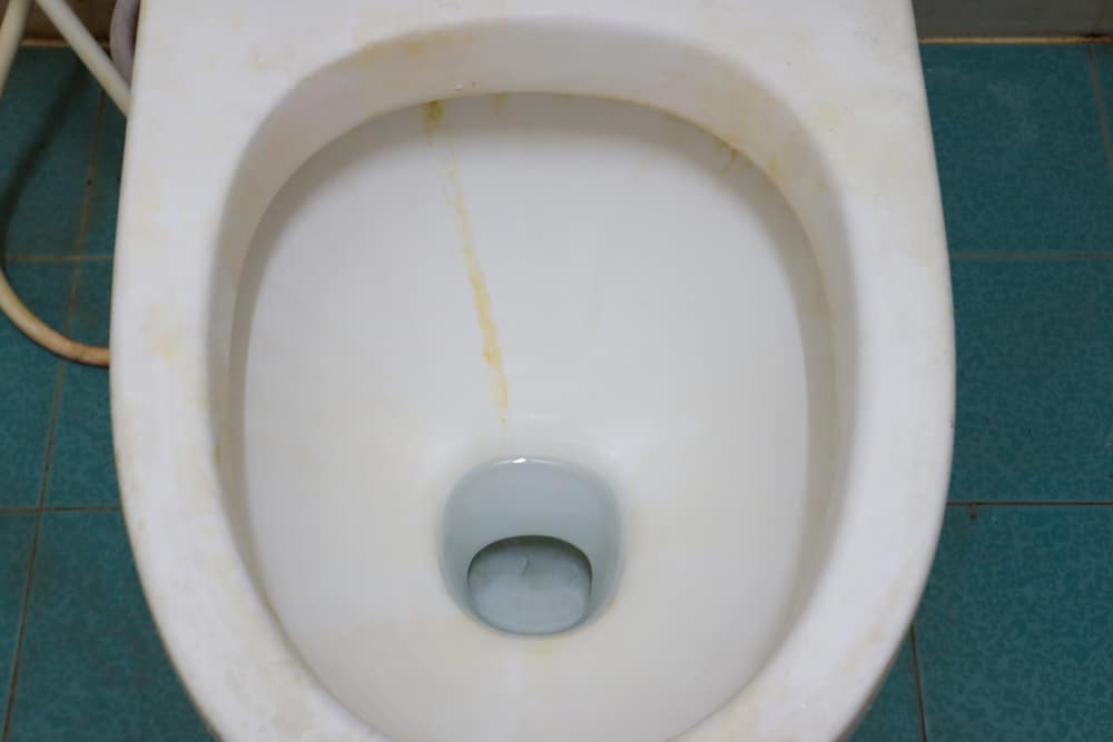 How to remove a Yellow stained toilet bowl?