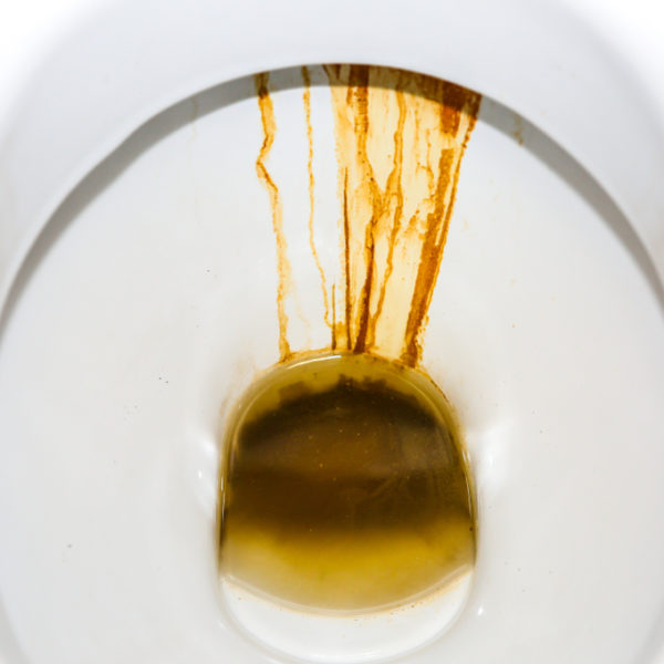 How to Remove Rust Stains from Toilets? (6 Easy Ways)