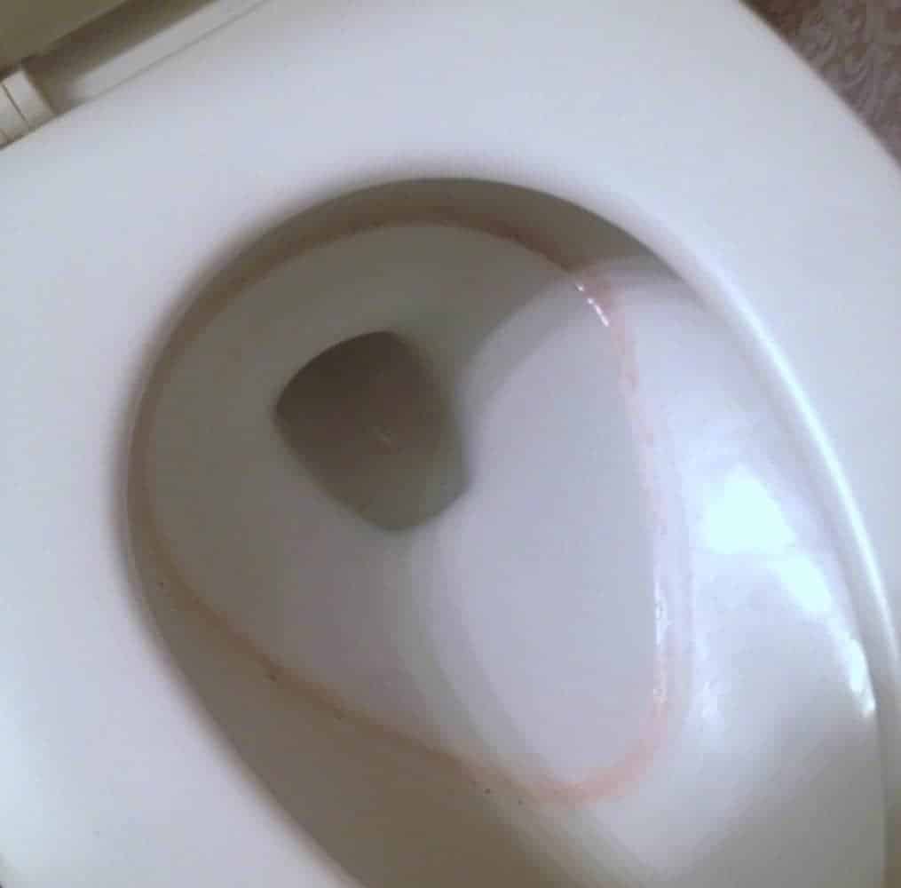 What causes pink ring in toilet bowl
