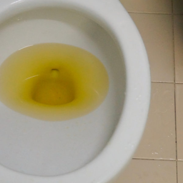 8 Reasons Why Your Toilet Water is Yellow (Causes & Solutions)