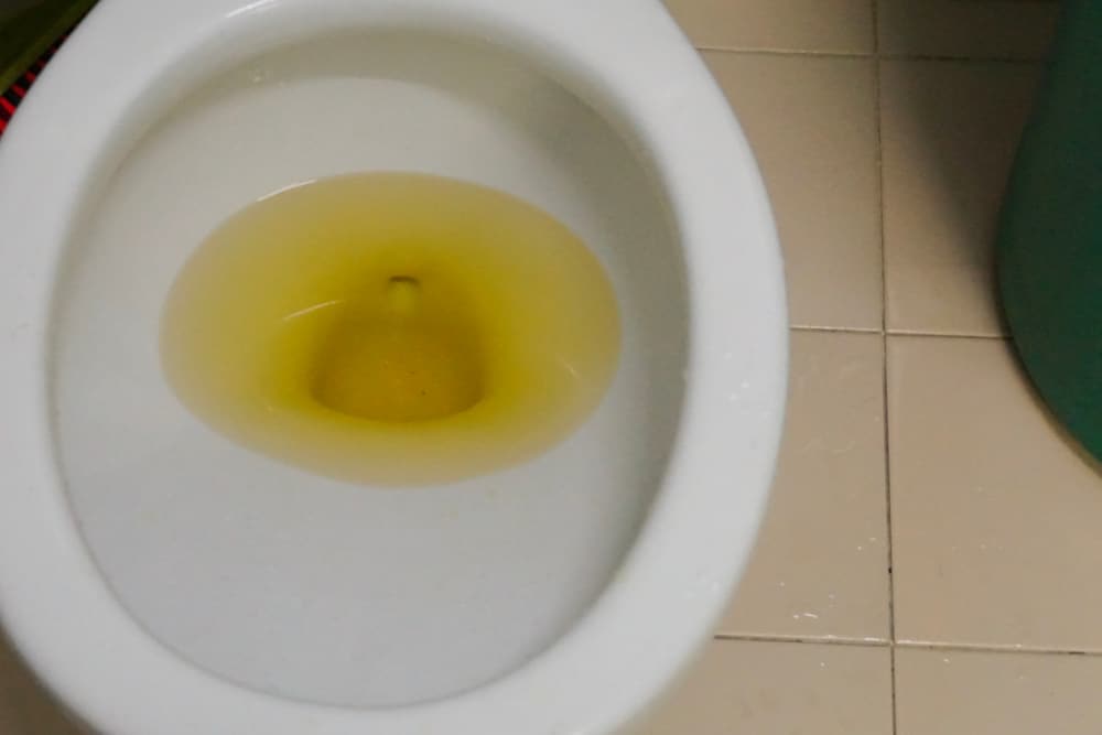 8 Reasons Why Your Toilet Water is Yellow (Causes & Solutions)